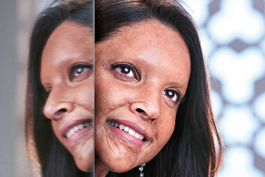 Chhapaak First Look: दीपिका पादुकोण का एसिड अटैक सर्वाइवर लुक, देखकर पहचान नहीं पाएंगे आप