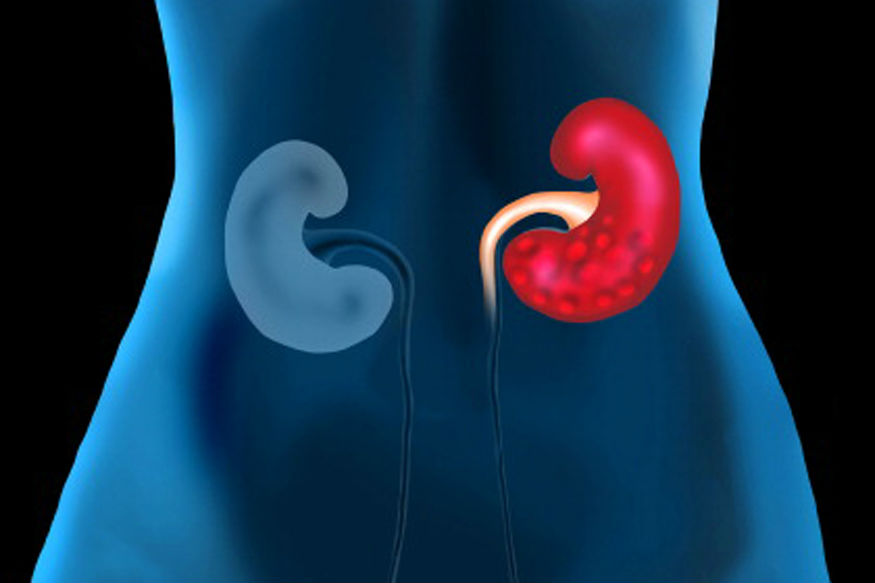 Kidney रहेगी हेल्दी अगर रोज खाएंगे पपीता, कभी नहीं होगी डायबिटीज़