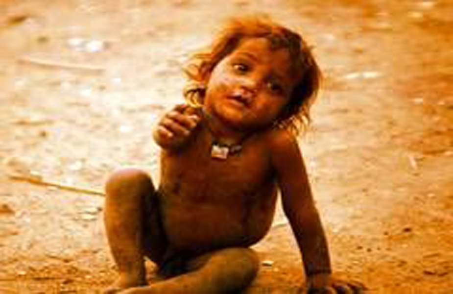 बाल कुपोषण, वर्ल्ड विजन इंडिया, बच्चों की स्थिति का आकलन, निचले पायदान पर मध्य प्रदेश, Child Malnutrition, World Vision India, Assessment of the Status of Children, Madhya Pradesh at the bottom rung