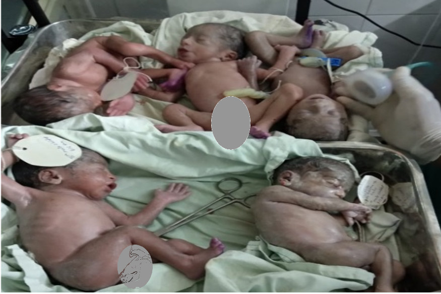 प र म च य र ड ल वर म मह ल न द य 5 बच च क जन म 3 लड क और 2 लड क य Woman Gave Birth To 5 Children In Jaipur 3 Boys And 2 Girls News18 Hindi