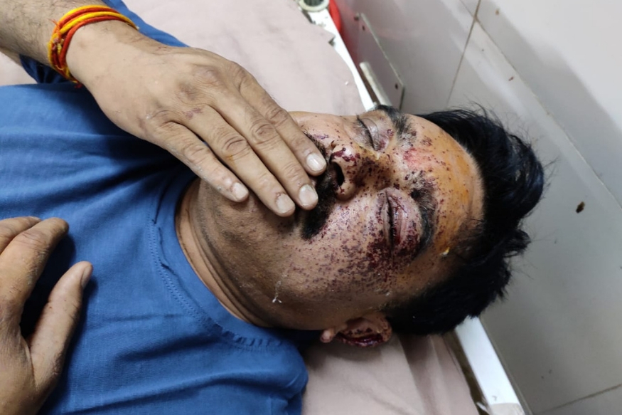घायल मोंठ प्रभारी निरीक्षक धर्मेद्र सिंह चौहान