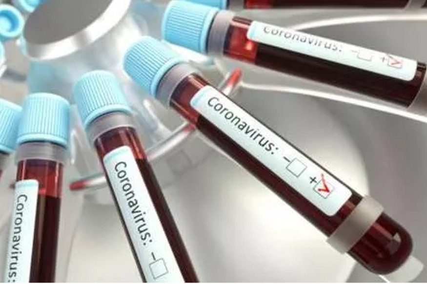 Coronavirus Lockdown, PM Modi, Narendra Modi, कोरोनावायरस, पीएम मोदी, नरेंद्र मोदी, लॉकडाउन, कोरोनावायरस के खिलाफ जंग में PM नरेंद्र मोदी ने लैब की संख्या बढ़ाने पर क्यों जोर दिया. coronavirus lockdown pm narendra modi insist on increasing the number of labs What does it mean