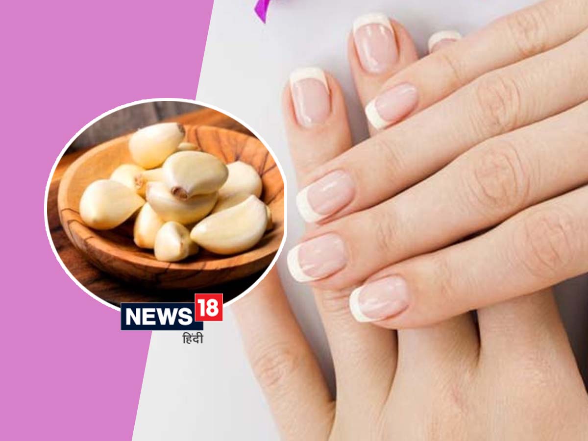 Healthy Nail Tips home remedies strong nail and majbut nakhun ke liye gharelu  upay bataye, Health Latest News in Hindi Newstrack Samachar | Healthy Nail  Tips: सर्दियों में ज्यादा टूटते हैं नाखून,